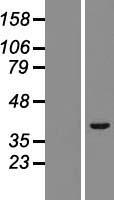 ls084851 trim52 human over expression lysates nm 032765 wb testing 1