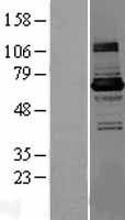 KLHL22 Human Over-expression Lysates NM_032775