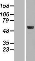 MINA53 (MINA) Human Over-expression Lysates NM_001042533