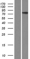 CCDC142 Human Over-expression Lysates NM_032779