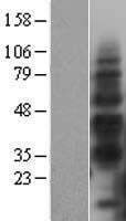 TIM 3 (HAVCR2) Human Over-expression Lysates NM_032782