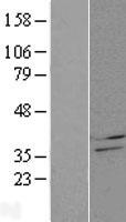 CBR4 Human Over-expression Lysates NM_032783