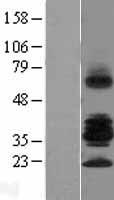 RSPO3 Human Over-expression Lysates NM_032784