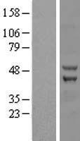 ZC3H10 Human Over-expression Lysates NM_032786