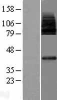 ls084879 mfsd2a human over expression lysates nm 032793 wb testing 1