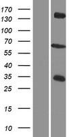 ZDH12 (ZDHHC12) Human Over-expression Lysates NM_032799