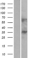 C1orf198 Human Over-expression Lysates NM_032800