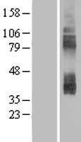 SLC7A3 Human Over-expression Lysates NM_001048164