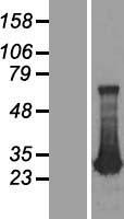 ADO Human Over-expression Lysates NM_032804