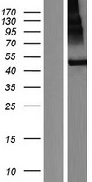 TMEM118 (RNFT2) Human Over-expression Lysates NM_032814
