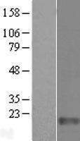 FAM136A Human Over-expression Lysates NM_032822