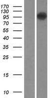 ls084910 tmem87b human over expression lysates nm 032824 wb testing 1