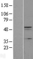 C12orf34 (FAM222A) Human Over-expression Lysates NM_032829