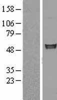 FIZ1 Human Over-expression Lysates NM_032836