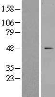 ZNF566 Human Over-expression Lysates NM_001145345