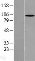 MASTL Human Over-expression Lysates NM_032844