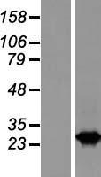 RAB2B Human Over-expression Lysates NM_032846