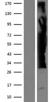 ZFYVE19 Human Over-expression Lysates NM_001077268