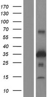 ZNRF1 Human Over-expression Lysates NM_032268