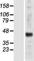 ls084941 hsh2d human over expression lysates nm 032855 wb testing 1