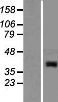 ABHD13 Human Over-expression Lysates NM_032859