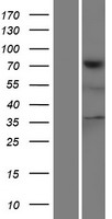 TNS4 Human Over-expression Lysates NM_032865