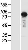 Sts1 (UBASH3B) Human Over-expression Lysates NM_032873