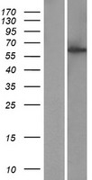 KIAA1984 (CCDC183) Human Over-expression Lysates NM_001039374