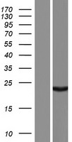 ALKBH6 Human Over-expression Lysates NM_198867
