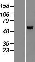 IGSF21 Human Over-expression Lysates NM_032880