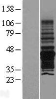 PNMA6A Human Over-expression Lysates NM_032882