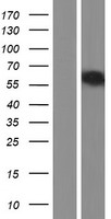 ls084969 tox2 human over expression lysates nm 001098797 wb testing 3