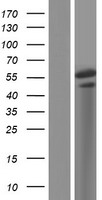 ls084969 tox2 human over expression lysates nm 001098798 wb testing 4