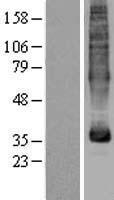 ls084975 mfsd5 human over expression lysates nm 032889 wb testing 1