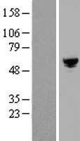 RGH19 (ARHGAP19) Human Over-expression Lysates NM_032900