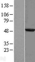 AGXT2L2 (PHYKPL) Human Over-expression Lysates NM_153373