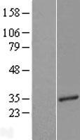 TCEAL3 Human Over-expression Lysates NM_032926