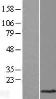 TMEM141 Human Over-expression Lysates NM_032928
