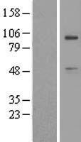 USP45 Human Over-expression Lysates NM_001080481