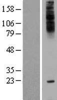 ls085019 c18orf45 tmem241 human over expression lysates nm 032933 wb testing 1