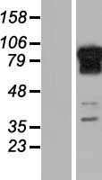REPS1 Human Over-expression Lysates NM_031922
