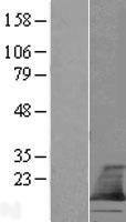 ls085025 tmem60 human over expression lysates nm 032936 wb testing 1