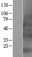 ls085291 krtap4 2 human over expression lysates nm 033062 wb testing 1