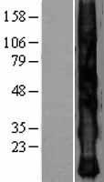 KRTAP2-4 Human Over-expression Lysates NM_033184