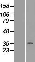 Progestin Receptor Beta (PAQR8) Human Over-expression Lysates NM_133367