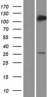 TRIM5 alpha (TRIM5) Human Over-expression Lysates NM_033034