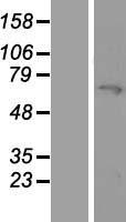 MYLK2 Human Over-expression Lysates NM_033118