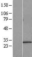ls085395 c21orf70 fam207a human over expression lysates nm 058190 wb testing 1