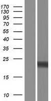 RGS8 Human Over-expression Lysates NM_001102450