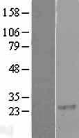 RGS8 Human Over-expression Lysates NM_033345